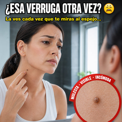 VerruWart™ | Elimina Verrugas Desde la Raíz Sin Dolor