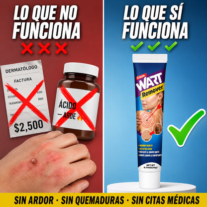VerruWart™ | Elimina Verrugas Desde la Raíz Sin Dolor